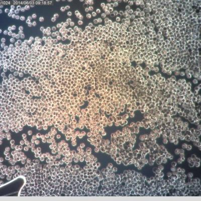Agregace Erytrocytu Chlamydie Acidoza Chemikalie Prekarcinom Delozniho Cipku