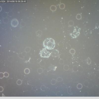 Bile Krvinky Tezkymi Kovy Toxicke Prostredi Je Zabiji Oxidativni Stres Hemolyza Erytrocytu Alergie Astma Unavovy Syndrom
