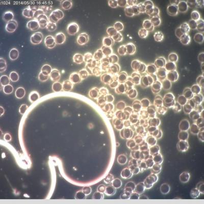 Chemikalie V Krvi Lecba Artritidy Kortikoidy
