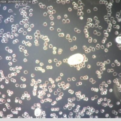 Chlamydie Pneumonie Na Krvinkach A Chemikalie V Krvi Caste Infekce Rymy Dutiny Zanety Prudusek A Usi
