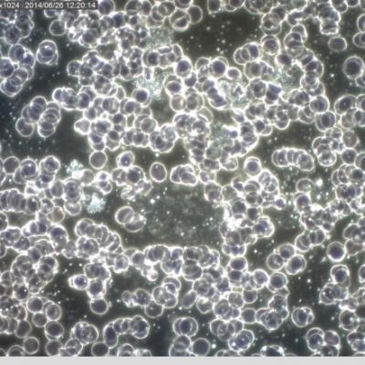 Metabolicke Zbytky Tezke Kovy Agregace Trombocytu Diabetes Ii. Typu Bercove Vredy Nadvaha