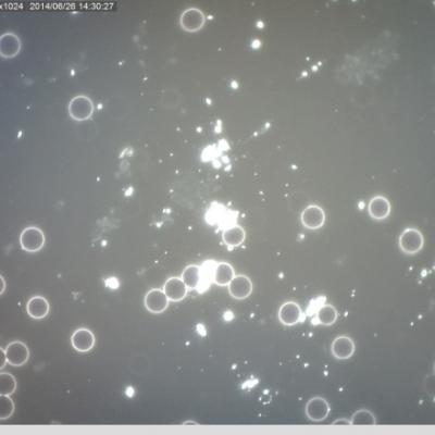 Tezke Kovy Plisnove Paraziticke Formy Hemolyza Erytrocytu Oxidativni Stres Unava Akne Padani Vlasu